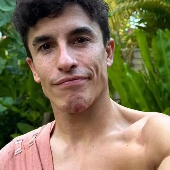 Marc Marquez Ungkap Kondisi Cedera Usai Insiden MotoGP Mandalika 2025