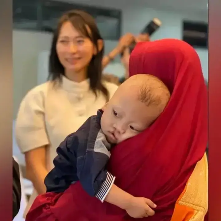 Operasi Bibir Sumbing: Lebih dari Estetika, Kunci Tumbuh Kembang Optimal Anak